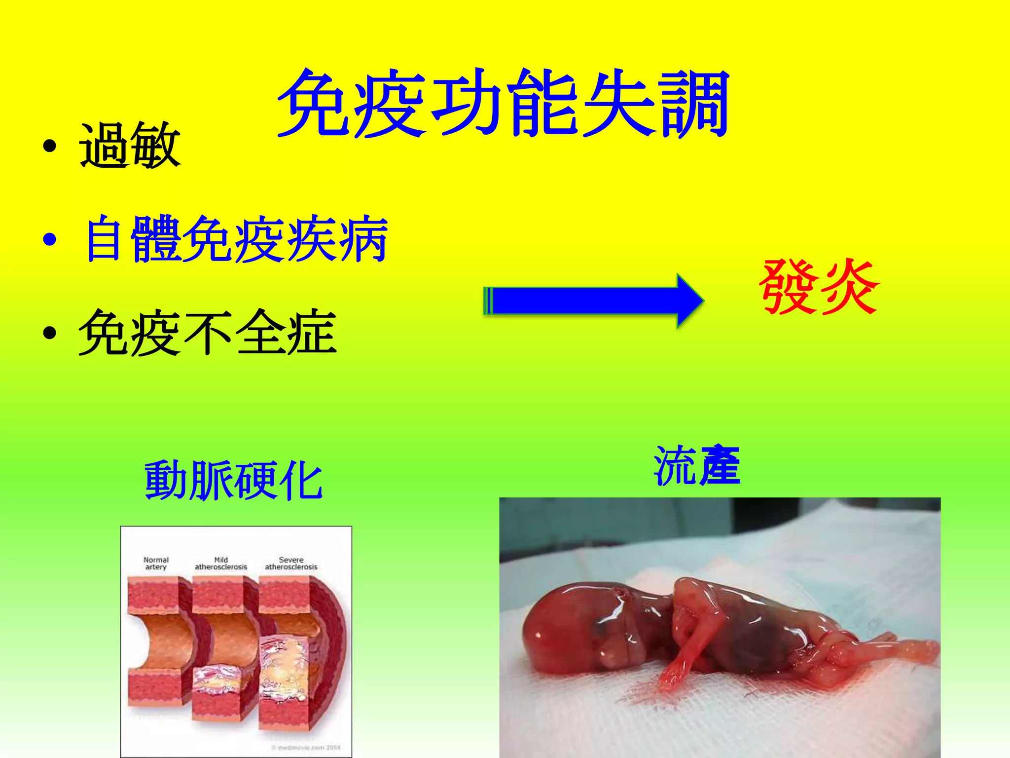 • 過敏

免疫功能失調

• 自體免疫疾病

發炎

• 免疫不全症
動脈硬化

流產

 