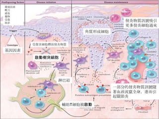 環境因素
壓力
感染
藥物
受傷
抽菸

發炎物質訊號吸引
更多發炎細胞過來
角質形成細胞
受傷害細胞釋放發炎物質

基因因素
啟動樹突細胞

淋巴結
一部分的發炎物質訊號隨
著血液流竄全身，進而引
起關節炎
輔助T細胞被啟動

 