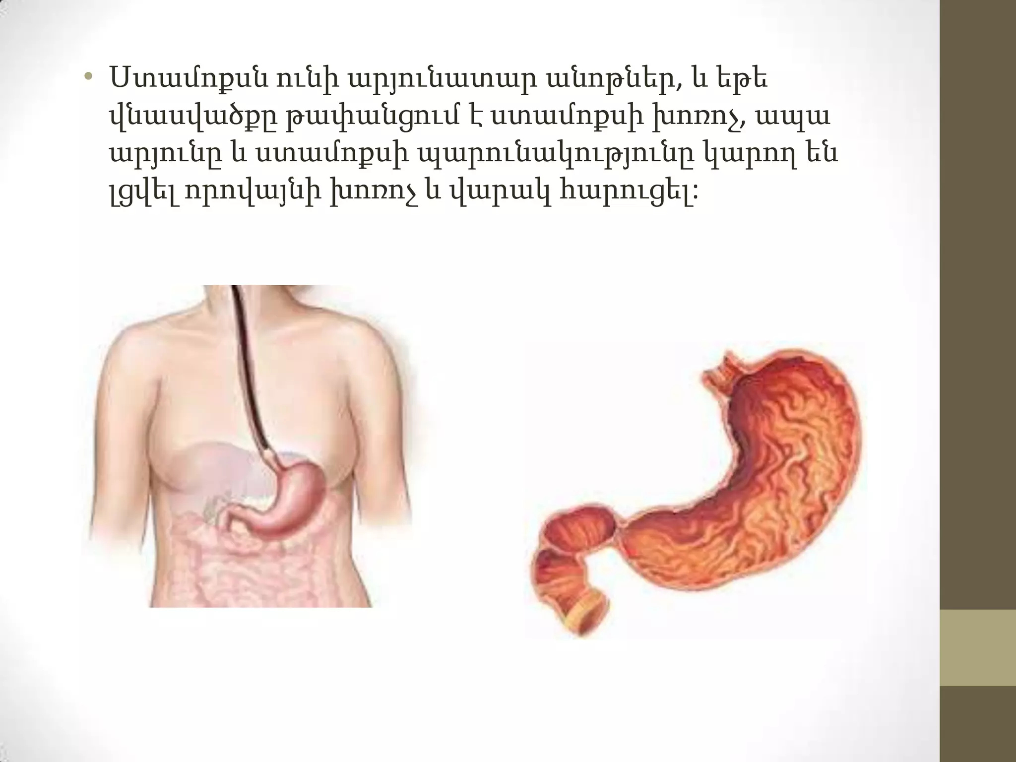 • Ստամոքսն ունի արյունատար անոթներ, և եթե
վնասվածքը թափանցում է ստամոքսի խոռոչ, ապա
արյունը և ստամոքսի պարունակությունը կարող են
լցվել որովայնի խոռոչ և վարակ հարուցել:

 