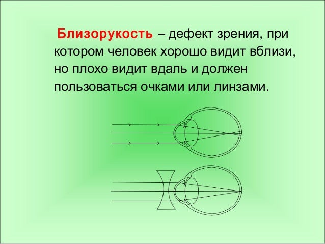 Схема глаза при близорукости и дальнозоркости. Дефекты зрения. Дефекты зрения физика. Дефекты зрения и их коррекция. Схема близорукости и дальнозоркости.