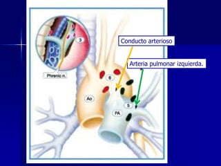 Conducto arterioso
Arteria pulmonar izquierda.

 