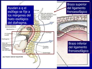Ayudan a q el
esófago se fije a
los márgenes del
hiato esofágico
del diafragma.

Brazo superior
del ligamento
frenoesofágico

Brazo inferior
del ligamento
frenoesofágico

 