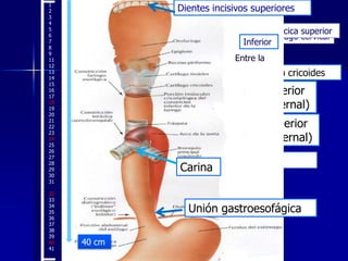 1
2
3
4
5
6
7
8
9
11
12
13
14
15
16
17
18
19
20
21
22
23
24
25
26
27
28
29
30
31
32
33
34
35
36
37
38
39
40
41

Dientes incisivos superiores
Porción torácica superior
Esófago cervical
Inferior
Entre la

18 cm

Borde inferior del cartílago cricoides

Estrecho torácico superior
(escotadura supraesternal)
Estrecho torácico superior
(escotadura supraesternal)

24 cm

Bifurcación traqueal.

Carina

Porción torácica media
32 cm

UniónUnión gastroesofágica
gastroesofágica
40 cm

 