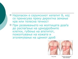 Деформитети на дигестивниот систем и превенција | PPT