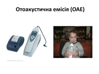 Отоакустична емісія (ОАЕ)

 