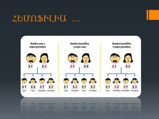 ՀԵՄՈՖԻԼԻԱ …

 