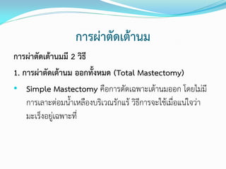 การผ่าตัดเต้านม
การผ่าตัดเต้านมมี 2 วิธี
1. การผ่าตัดเต้านม ออกทั้งหมด (Total Mastectomy)
• Simple Mastectomy คือการตัดเฉพาะเต้านมออก โดยไม่มี
การเลาะต่อมนาเหลืองบริเวณรักแร้ วิธีการจะใช้เมื่อแน่ใจว่า
มะเร็งอยู่เฉพาะที่

 