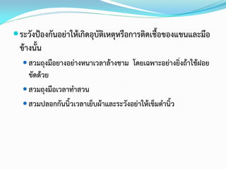  ระวังป้องกันอย่าให้เกิดอุบัติเหตุหรือการติดเชื้อของแขนและมือ

ข้างนั้น
 สวมถุงมือยางอย่างหนาเวลาล้างชาม โดยเฉพาะอย่างยิ่งถ้าใช้ฝอย

ขัดด้วย
 สวมถุงมือเวลาทาสวน
 สวมปลอกกันนิ้วเวลาเย็บผ้าและระวังอย่าให้เข็มตานิ้ว

 