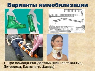 Варианты иммобилизации

1. При помощи стандартных шин (лестничные,
Дитерихса, Еланского, Шанца).

 
