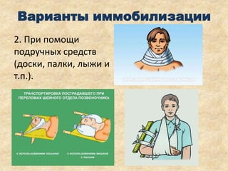 Варианты иммобилизации
2. При помощи
подручных средств
(доски, палки, лыжи и
т.п.).

 