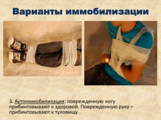 Варианты иммобилизации

3. Аутоиммобилизация: поврежденную ногу
прибинтовывают к здоровой. Поврежденную руку –
прибинтовывают к туловищу.

 