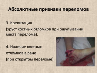 Абсолютные признаки переломов
3. Крепитация
(хруст костных отломков при ощупывании
места перелома).
4. Наличие костных
отломков в ране
(при открытом переломе).

 