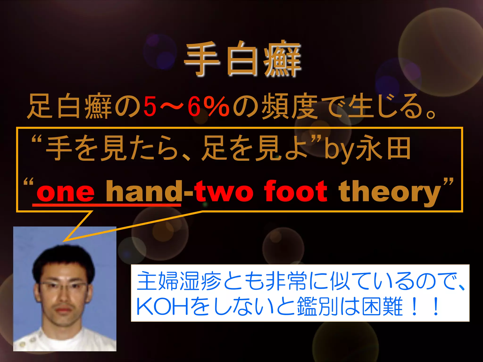 手白癬	
　足白癬の5～6％の頻度で生じる。
“手を見たら、足を見よ”by永田
“one hand-two foot theory”	
主婦湿疹とも非常に似ているので、
KOHをしないと鑑別は困難！！

 
