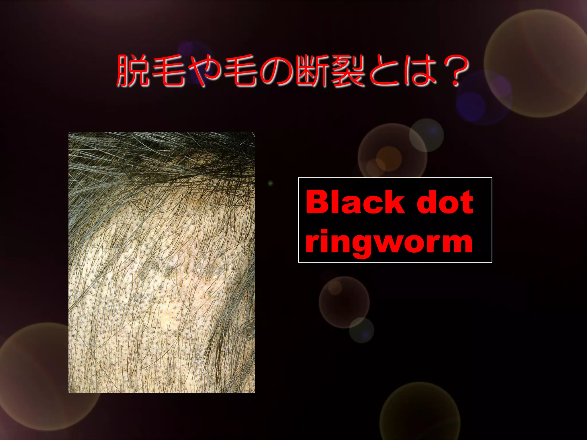 脱毛や毛の断裂とは？
Black dot
ringworm

 
