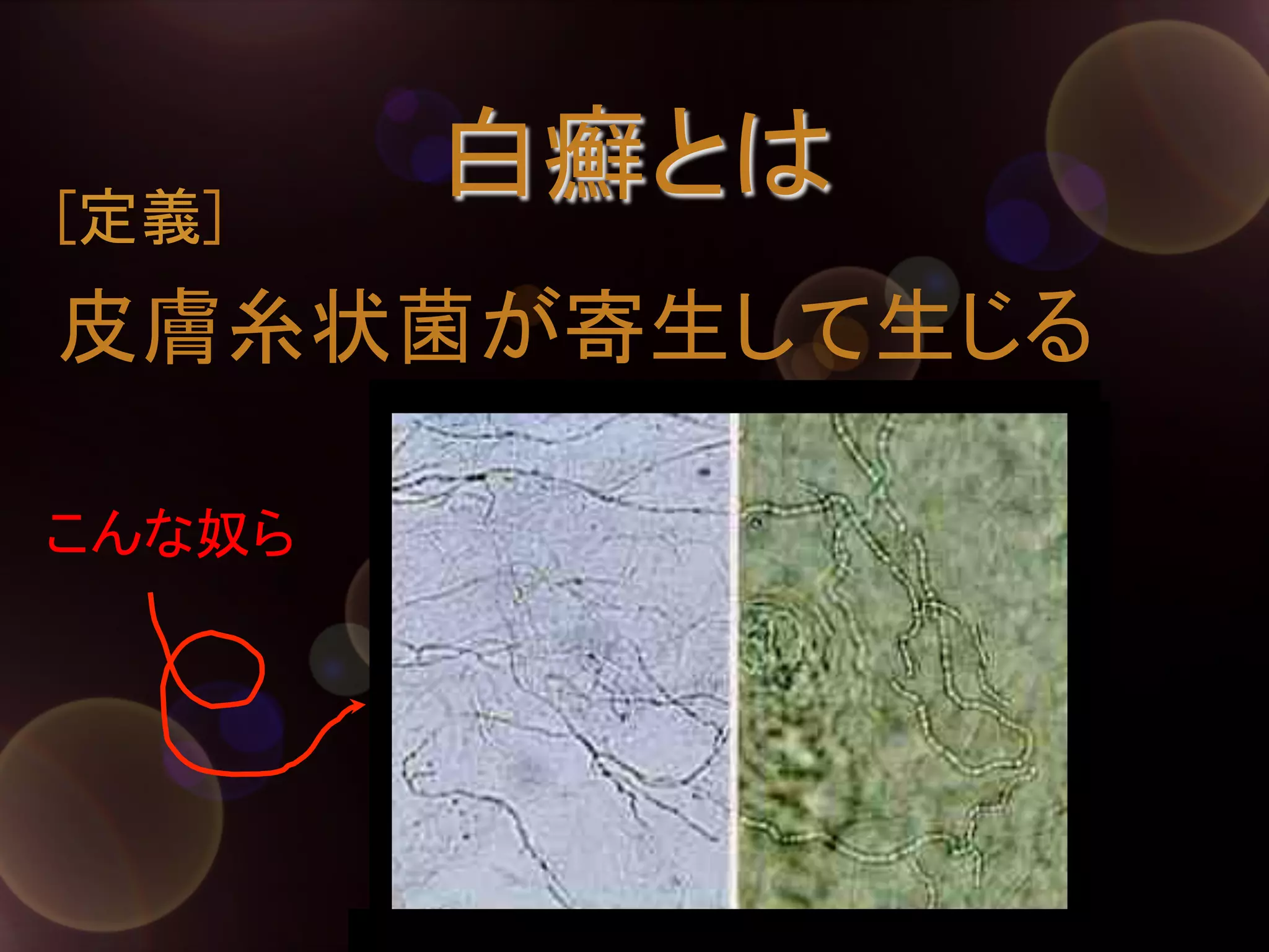 [定義]	

白癬とは	

皮膚糸状菌が寄生して生じる	
こんな奴ら	

 