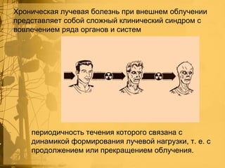 Хроническая лучевая болезнь при внешнем облучении
представляет собой сложный клинический синдром с
вовлечением ряда органов и систем

периодичность течения которого связана с
динамикой формирования лучевой нагрузки, т. е. с
продолжением или прекращением облучения.

 