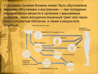 У человека лучевая болезнь может быть обусловлена
внешним облучением и внутренним — при попадании
радиоактивных веществ в организм с вдыхаемым
воздухом, через желудочно-кишечный тракт или через
кожу и слизистые оболочки, а также в результате
инъекции.

 