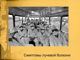 Симптомы лучевой болезни

 