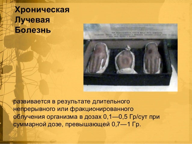 Боли в левом боку при беременности ночью