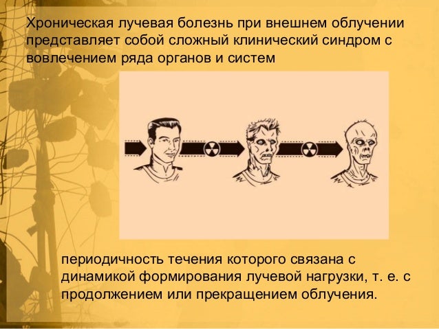 Лучевая болезнь