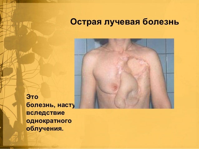 Лечение желчекаменных болезней без операционно