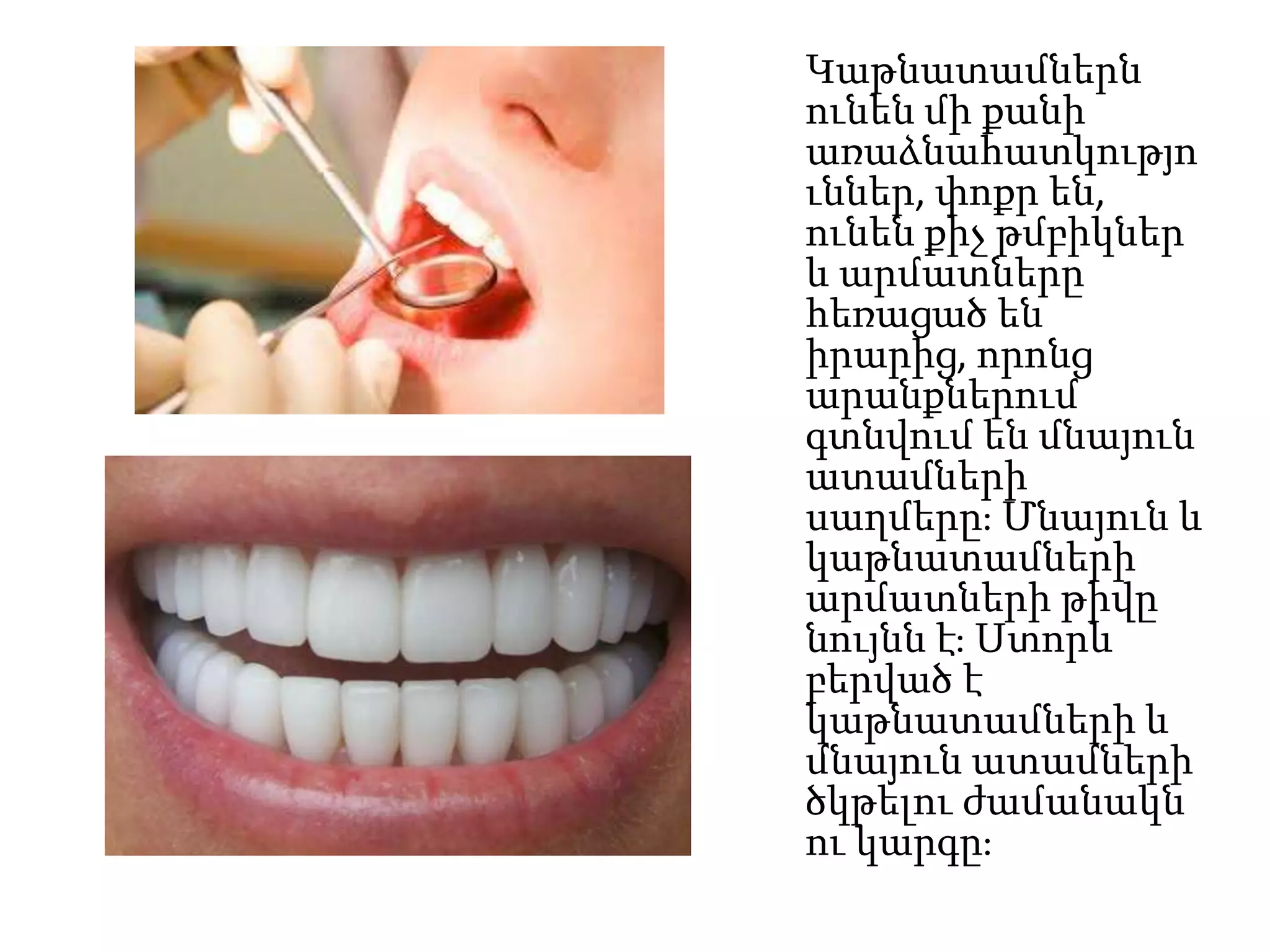 Կաթնատամներն
ունեն մի քանի
առաձնահատկությո
ւններ, փոքր են,
ունեն քիչ թմբիկներ
և արմատները
հեռացած են
իրարից, որոնց
արանքներում
գտնվում են մնայուն
ատամների
սաղմերը։ Մնայուն և
կաթնատամների
արմատների թիվը
նույնն է։ Ստորև
բերված է
կաթնատամների և
մնայուն ատամների
ծկթելու ժամանակն
ու կարգը։

 
