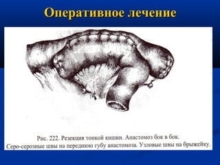 Оперативное лечение

 