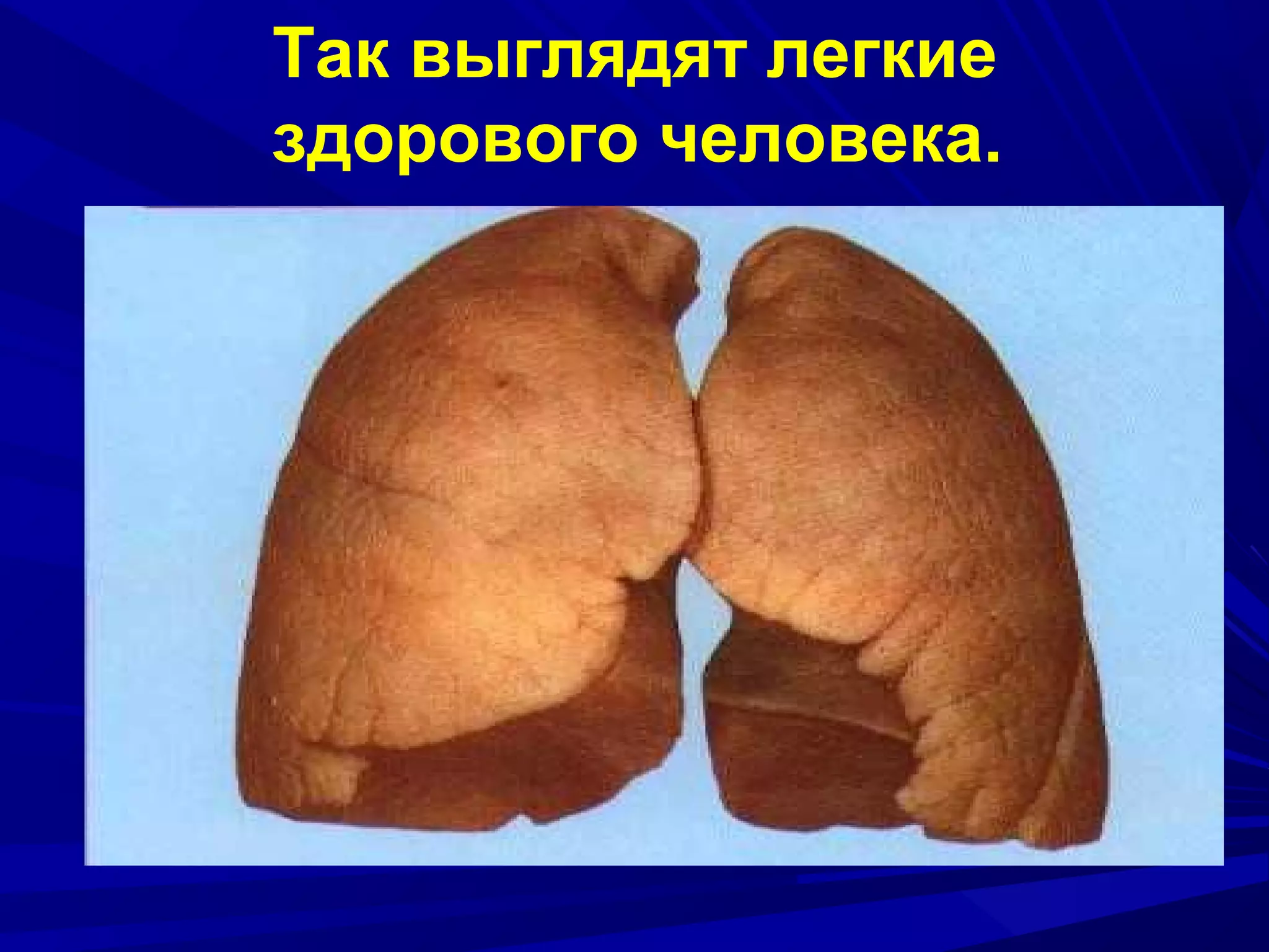 Так выглядят легкие
здорового человека.

 