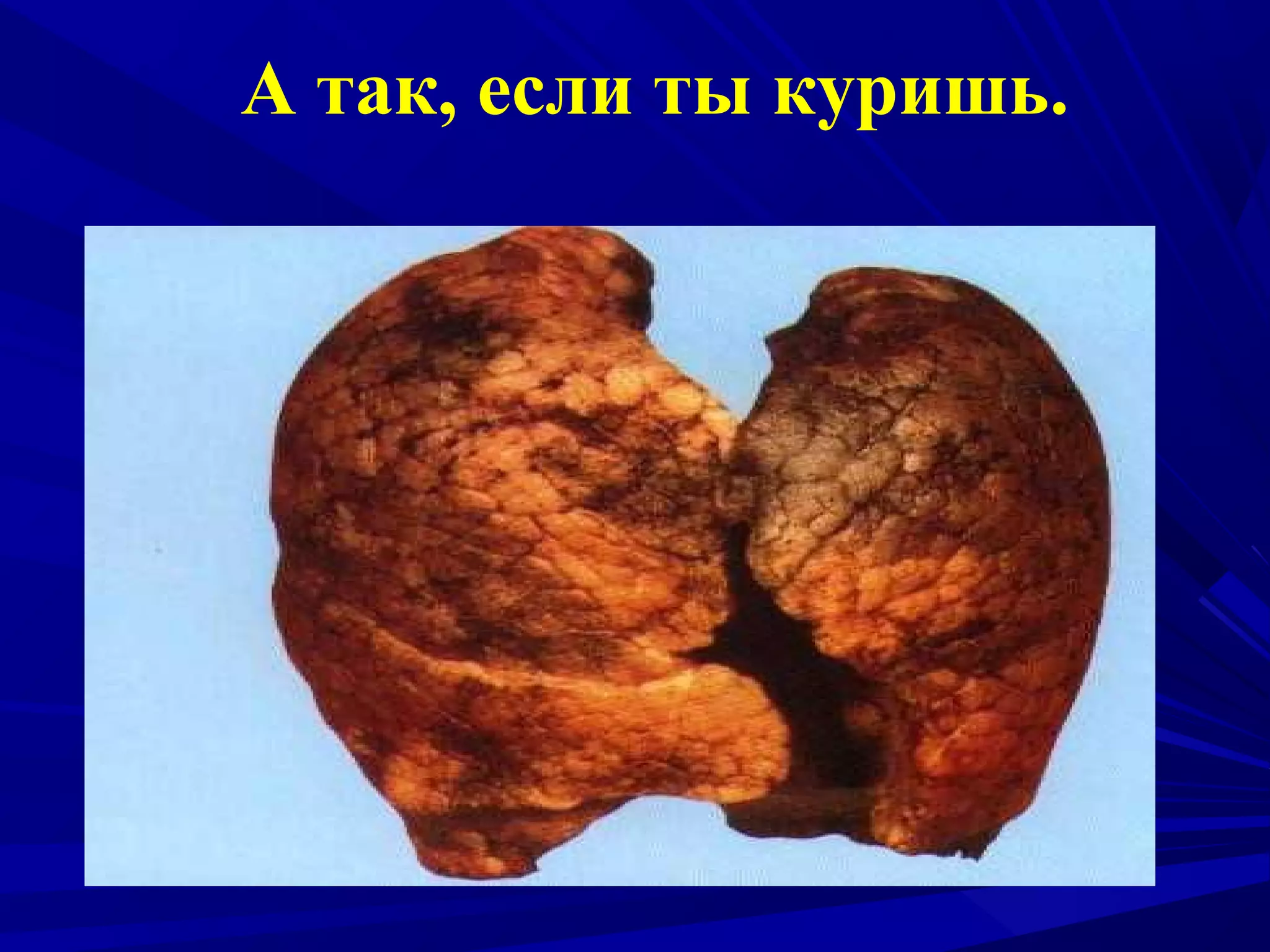 А так, если ты куришь.

 