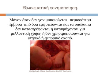 Εξωσωματική γονιμοποίηση.
Μόνον όταν δεν γονιμοποιούνται περισσότερα
έμβρυα από όσα εμφυτεύονται και τα υπόλοιπα
δεν καταστρέφονται ή καταψύχονται για
μελλοντική χρήση ή δεν χρησιμοποιούνται για
ιατρικό ή εμπορικό σκοπό.

Αλεξάνδρα Χ. Μάρα, Διευκφντρια 2ου ΠΠΓ Θες/νίκθσ.

 