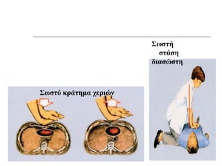 Σωστή
στάση
διασώστη

Σωστό κράτημα χεριών

12/18/13

 