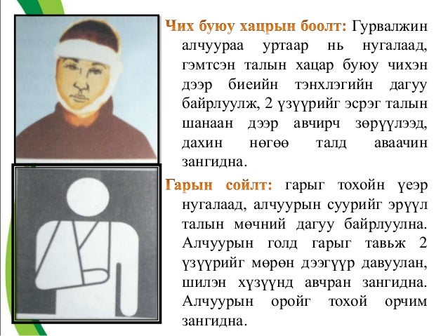 Анхны тусламж үзүүлэх семинар О.Батбаяр