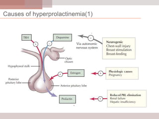 Causes of hyperprolactinemia(1)

 