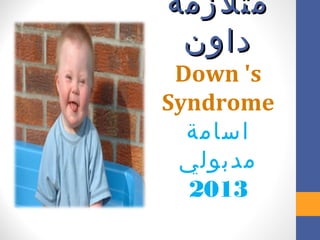 ‫متلزمة‬
‫داون‬

‫‪Down 's‬‬
‫‪Syndrome‬‬
‫اسامة‬
‫مدبولي‬
‫3102‬

 