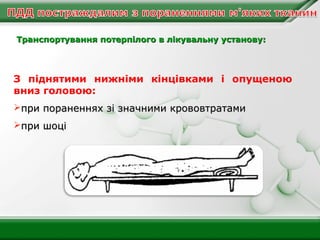 Транспортування потерпілого в лікувальну установу:

З піднятими нижніми кінцівками і опущеною
вниз головою:
при пораненнях зі значними крововтратами
при шоці

 