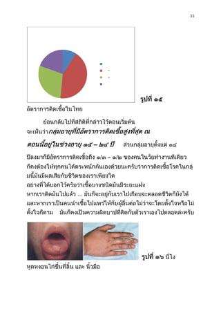 11

-

–
–

 