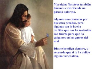 Moraleja: Nosotros también
tenemos cicatrices de un
pasado doloroso.
Algunas son causadas por
nuestros pecados, pero
algunas son la huella
de Dios que nos ha sostenido
con fuerza para que no
caigamos en las garras del
mal.
Dios te bendiga siempre, y
recuerda que si te ha dolido
alguna vez el alma,

 
