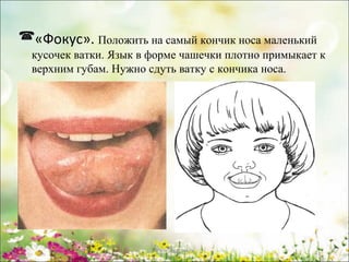 «Фокус». Положить на самый кончик носа маленький
кусочек ватки. Язык в форме чашечки плотно примыкает к
верхним губам. Нужно сдуть ватку с кончика носа.

www.logoped.ru

 