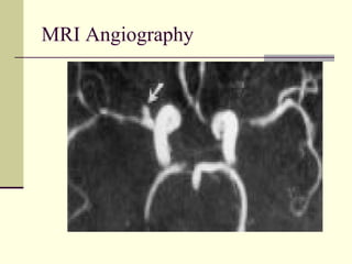 MRI Angiography

 