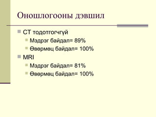Оношлогооны дэвшил
 CT тодотгогчгүй

Мэдрэг байдал= 89%
 Өвөрмөц байдал= 100%


 MRI

Мэдрэг байдал= 81%
 Өвөрмөц бай...