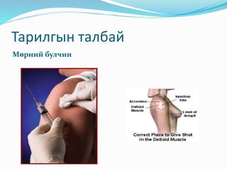 Тарилгын талбай
Мөрний булчин
 