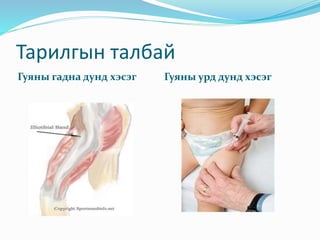 Тарилгын талбай
Гуяны гадна дунд хэсэг Гуяны урд дунд хэсэг
 