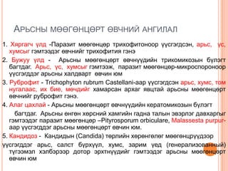 арьсны мөөгөнцөрт өвчний эмчилгээ.Uyangatsetseg | PPT