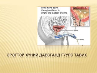 ЭРЭГТЭЙ ХҮНИЙ ДАВСГАНД ГУУРС ТАВИХ

 