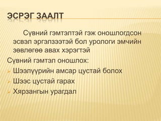 ЭСРЭГ ЗААЛТ
Сүвний гэмтэлтэй гэж оношлогдсон
эсвэл эргэлзээтэй бол урологи эмчийн
зөвлөгөө авах хэрэгтэй
Сүвний гэмтэл оношлох:
 Шээлүүрийн амсар цустай болох
 Шээс цустай гарах
 Хярзангын урагдал

 