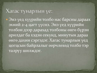  Энэ үед хүүрийн толбо нас барсны дараах

эхний 2-4 цагт үүснэ. Энэ үед хүүрийн
толбон дээр дарахад толбоны өнгө бүрэн
арилдаг ба хэдэн секунд, минутын дараа
өнгө дахин сэргэдэг. Хагас тунарлын үед
цогцсын байрлалыг өөрчлөхөд толбо тэр
талруу шилждэг.

 