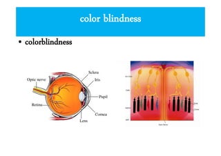color blindness
• colorblindness

 
