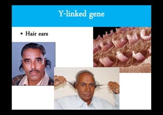 Y-inheritance
Y-linked gene
• Hair ears

 