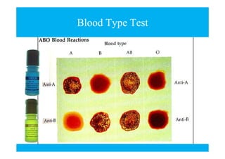 Blood Type Test

 
