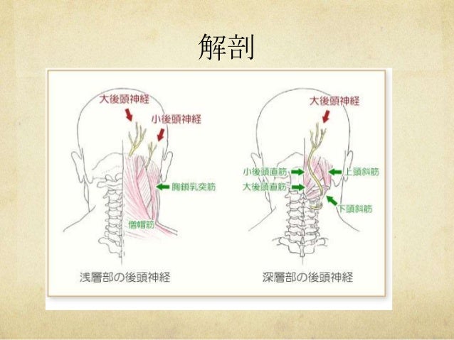 後頭神経痛 後頭神経痛